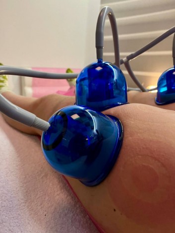 Апаратний вакуумно-роликовий масаж, курс 5 сеансів по 60 хв